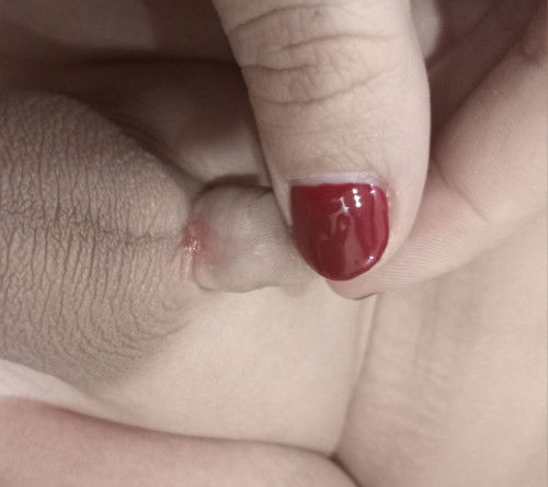 Bagian bawah pisang anaku sedikit merah