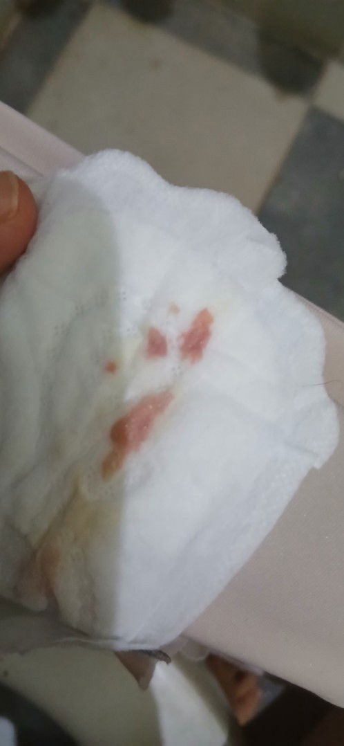 keluar flek darah di 38w 5d