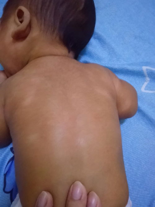 Tompok tompok putih di badan