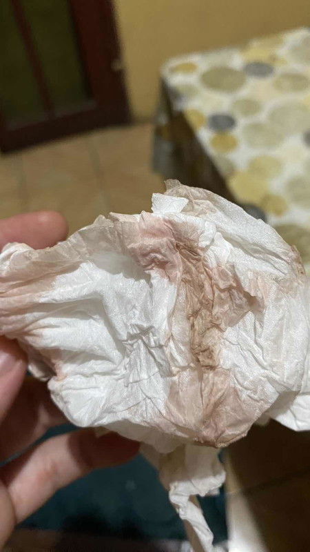 Mau tanya ada flek tapi kata bidan nya blum pembukaan