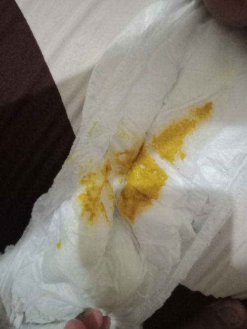 Bayi 4 bulan sering pup