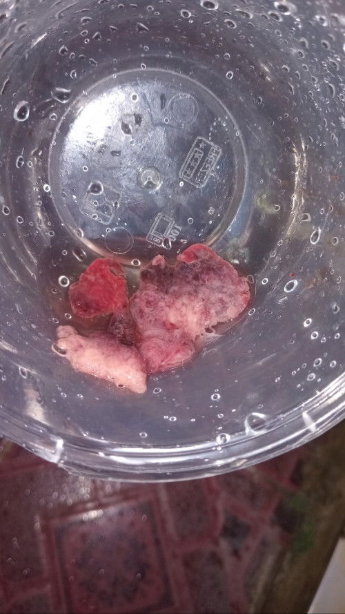 Bun ini keguguran atau bukan