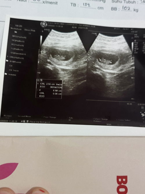 Kehamilan 9 week