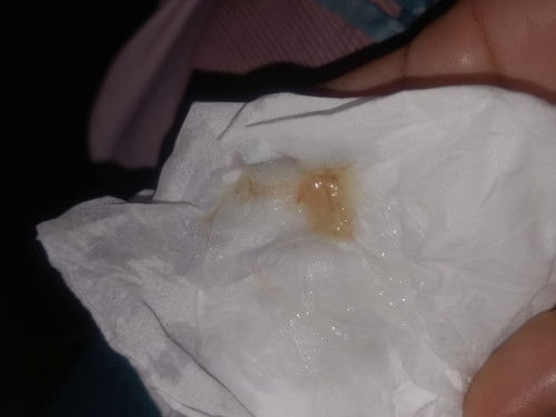 แบบนี้ใกล้คลอดมั้ยค่ะแม่ๆ