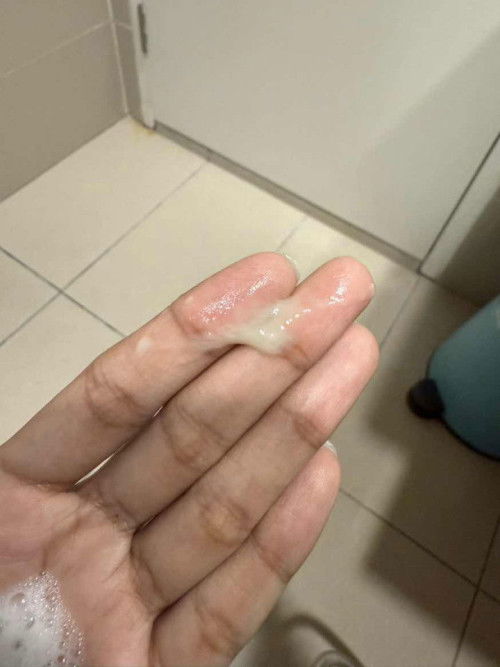 Keputihan 2nd trimester