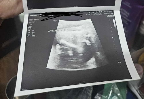 Baby’s gender