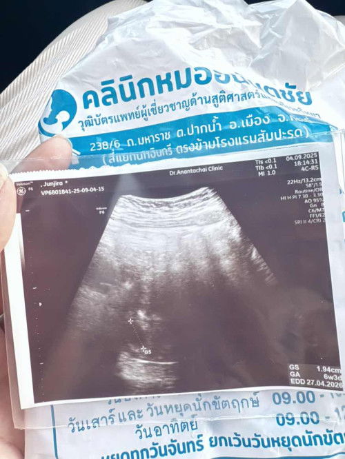 เจอน้องกี่วีคค่ะ