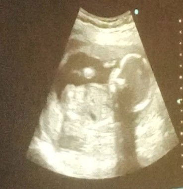 Girl or Boy?