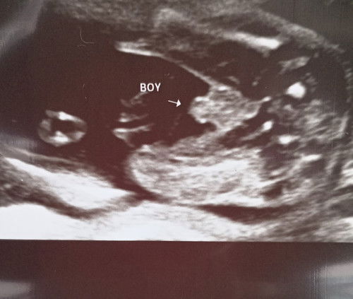 SCAN GENDER