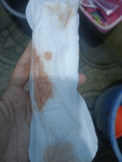 Kita kira ini darah atau keputihan bun ?