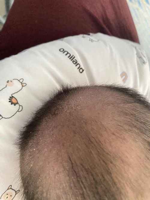 Kulit Kepala Baby