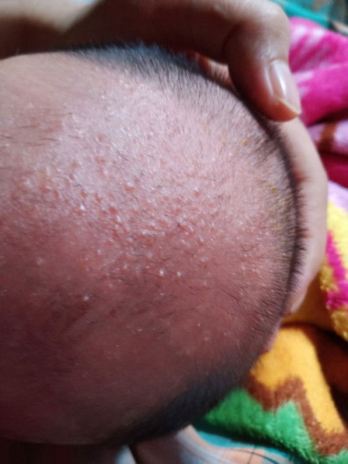 Bintik bintik merah dan putih