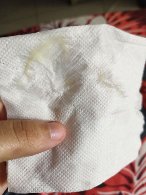 Keputihan atau spotting? Xda rasa gatal.. sya pregnant 7w 3d..