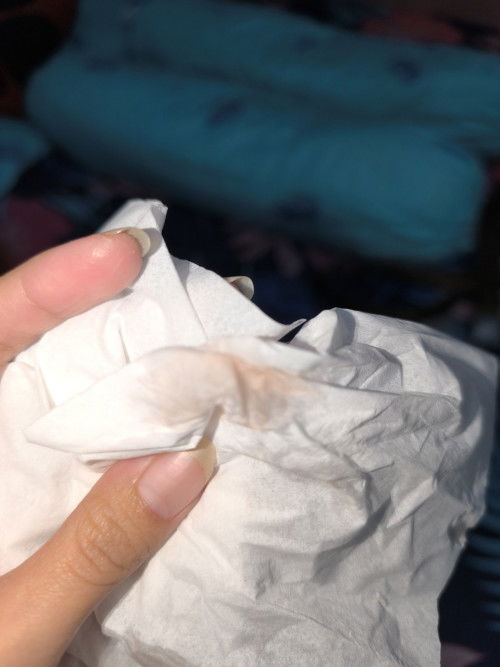 Bun mau tanya, masuk 7weeks trs sempet keluar kaya yg difoto, apa itu flek?