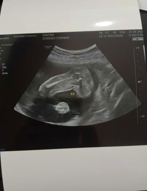 Girl kan mommy??