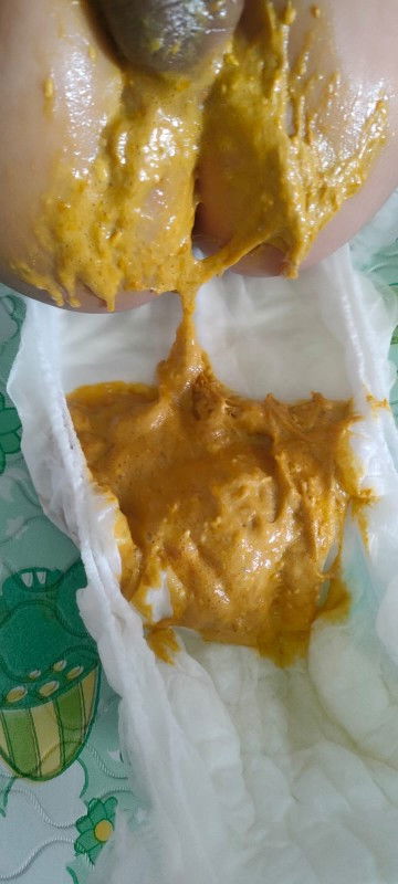 Bayiku baru beberapa hari