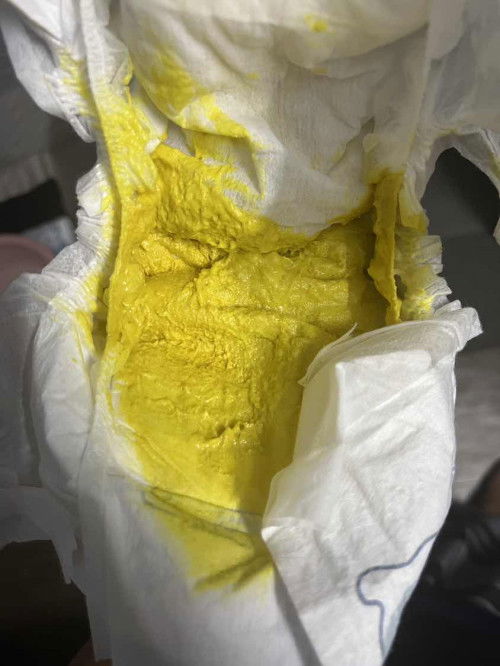 Bayi berak masa menangis