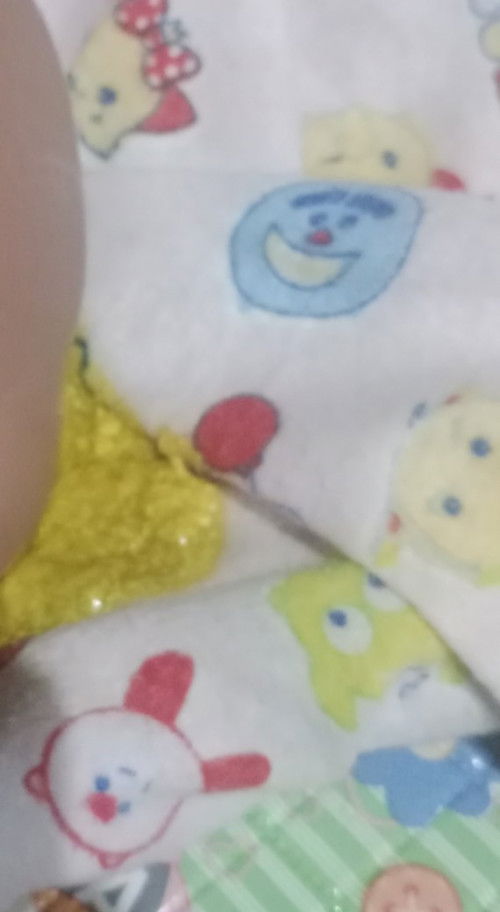 Apakah diare atau tidak pada bayi 1 bulan 10 hari