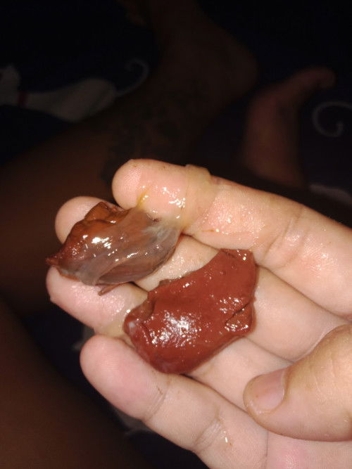 แม่ๆเมื่อวานตอนเยนมีมูกใสเหนียวๆอออกมาเป็นช่วงๆค่ะ แล้วสักพัก ก้อเอาทิชชู่เช็ด แล้วออกมาเปนก้อนแบบนี