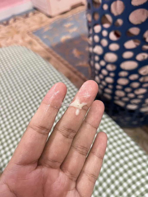 mucus plug atau keputihan
