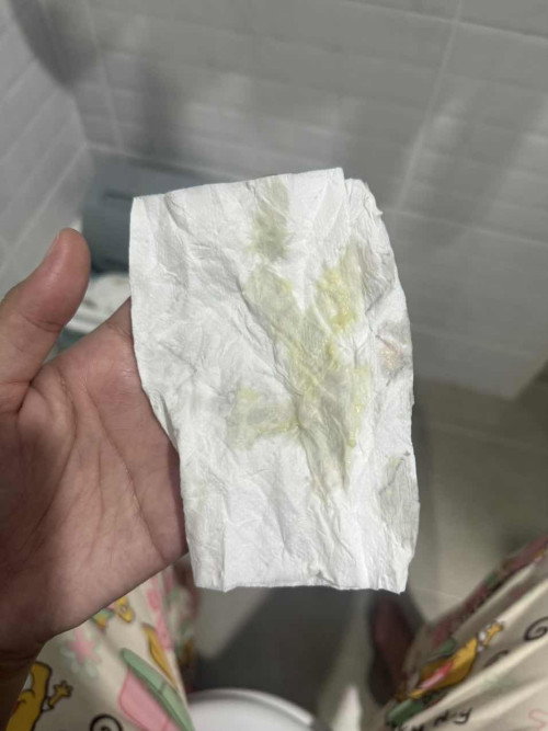 มีตกขาว สีเขียวขุ่นๆ ก้อนๆเหมือนนมบูด