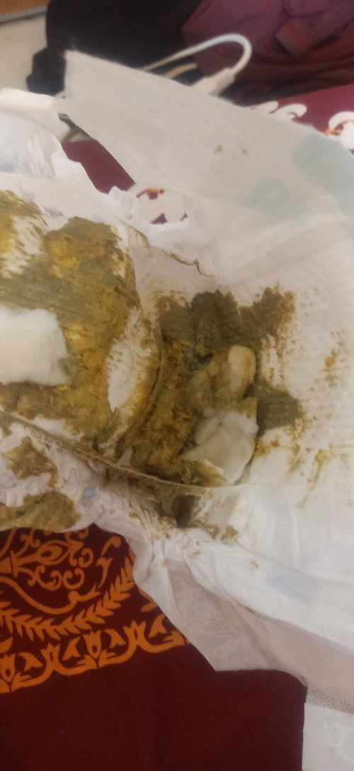 Bunda mau tanya, bayiku 3 bulan tapi pupnya begini.. kenapa ya kira kira?