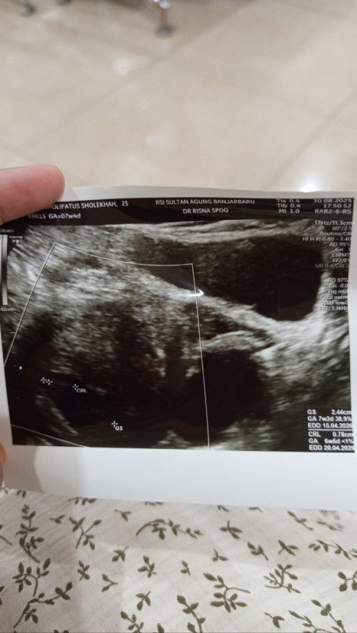 Bantu kasih pencerahannya yaa bunda"