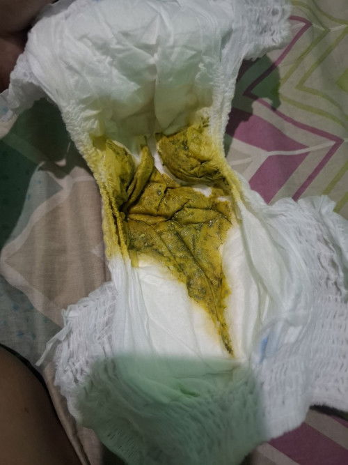 bab warna hijau usia anak 4 bulan