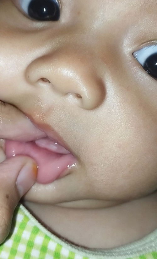 Tumbuh gigi umur 4bln