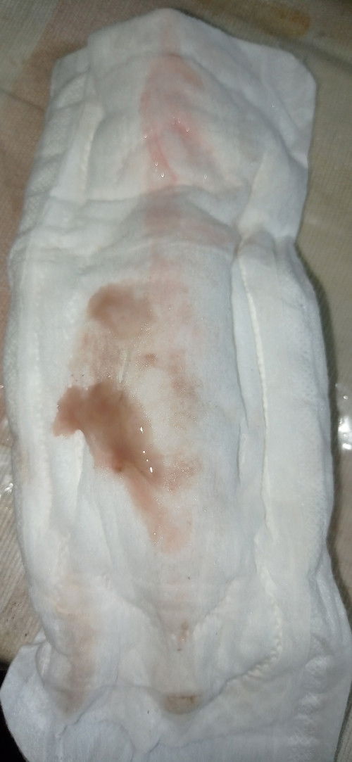 Lendir kecoklatan usia kandungan 39week