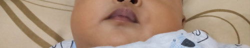 Bun mau nanya ini bibir anak saya biru apa normal yaa