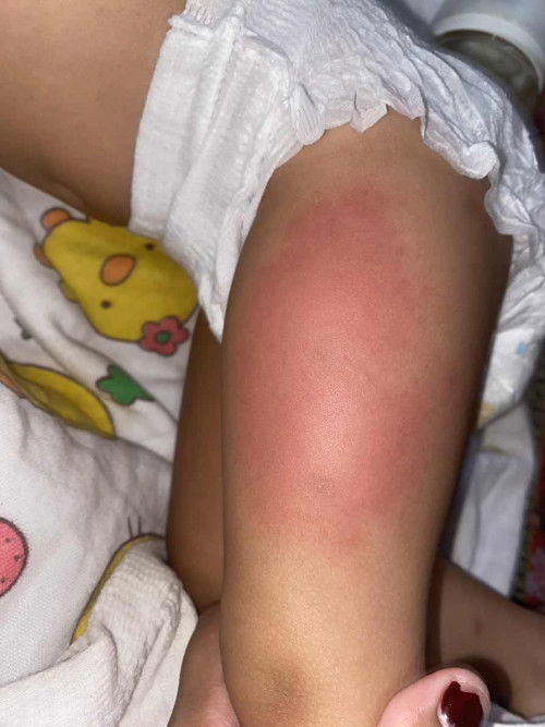 ขอถามนะคะแม่ๆ