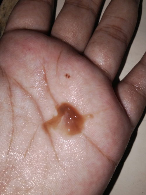 Keluar lendir coklat