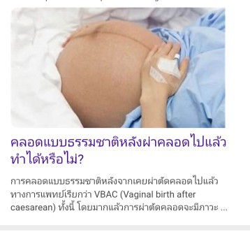 คลอดแบบ (VBAC) คลอดแบบธรรมชาติ หลังจากผ่าท้องแรก