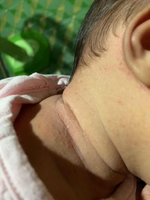คอน้องเป็นงี้มีวิธีให้หายมั้ย