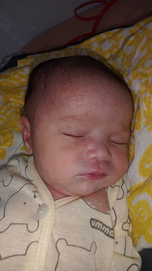 Biang keringet kah atau apa yaa?