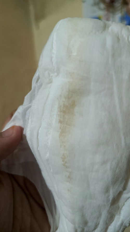 Bunda mau tanya, ini flek atau bukan ya usia hamil 12minggu