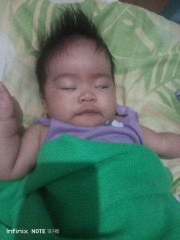 Normal lang po ba sa baby parang naduduling Mata pababa? 3months old baby po anak ko