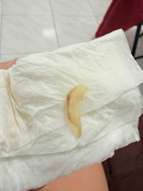 Mucus plug