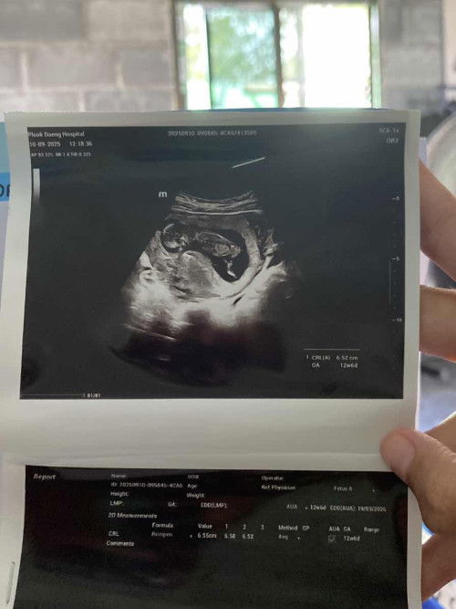 แม่ๆคะในใบซาวด์มีน้ำหนักลูกในครรภ์มั้ยคะ