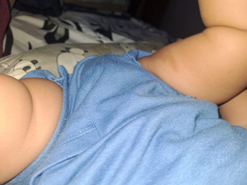 Mau tanya dong bun cara ngilangin di dkt selangkangan.bayi ada item, efek pampers pas bayi