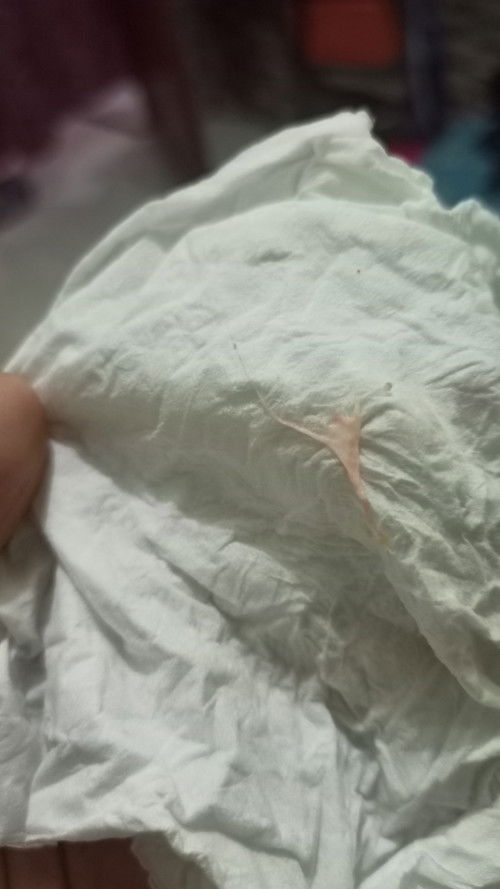 Pompa asi keluar kental seperti lembaran agak kemerahan