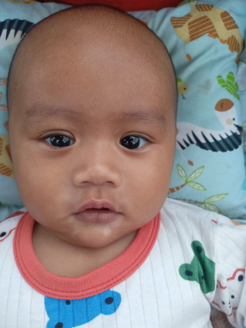 Bercak putih di muka