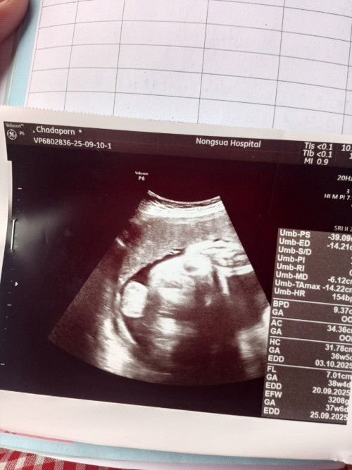 แม่ๆบ้านไหนไปซาวด์น้องแล้วหมอบอกว่าอาจจได้ผู้ชายคือผลจะแม่นแค่ไหนค่ะอายุครรภ์ได้35+6