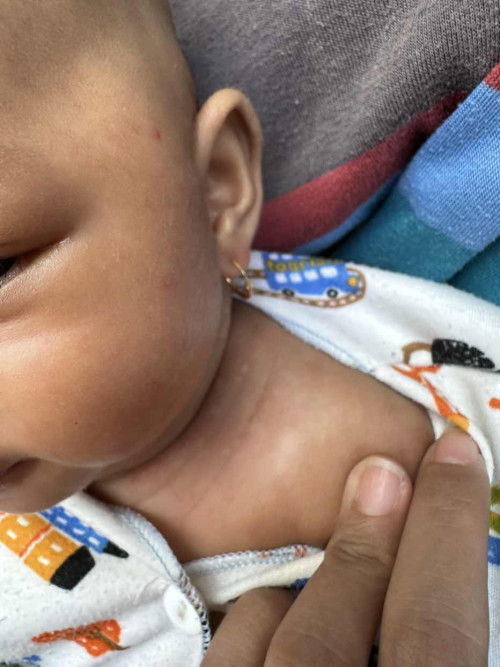 Muncul bercak2 putih bagian leher dan sekitar leher