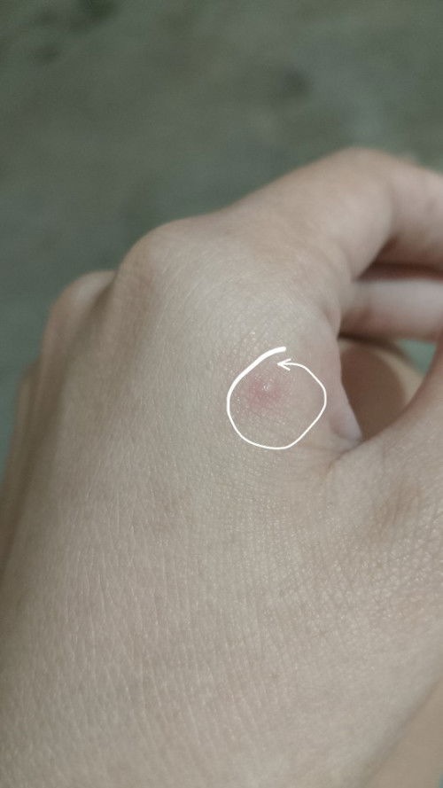Normal lag ba to' sa buntis??