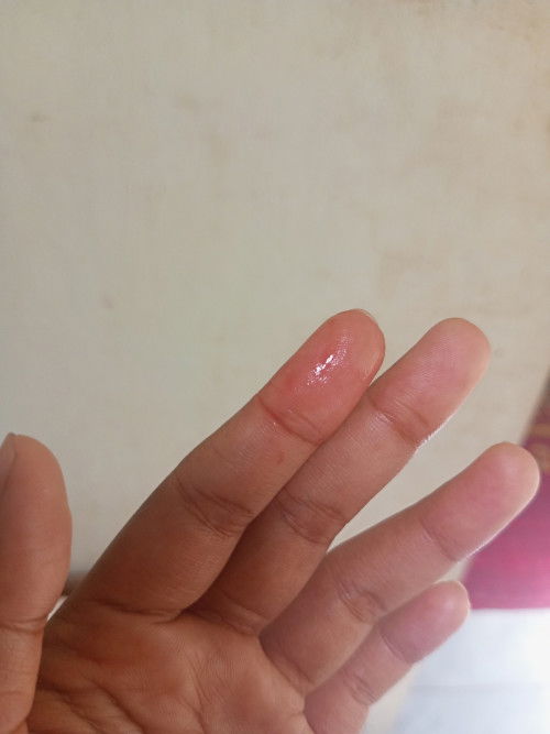 Hallo bund saya mau tanya seputar kehamilan nih