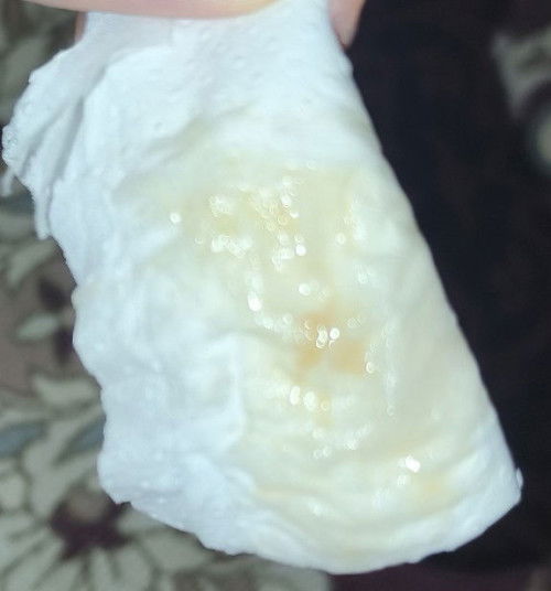 AIR KELUAR MELALUI FARAJ