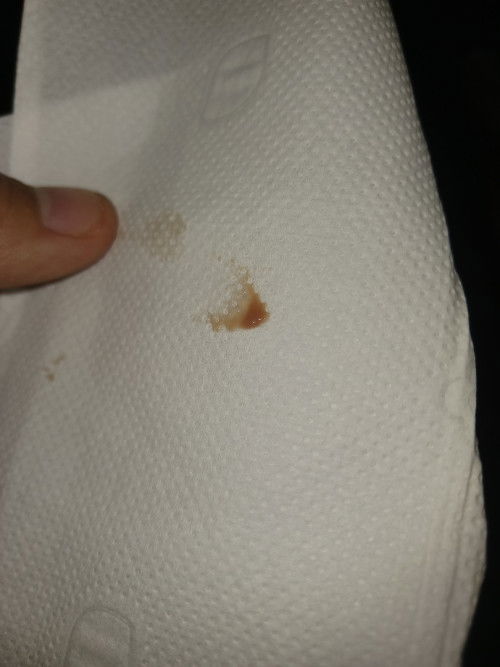 Tre kih sieu am ngi co thai