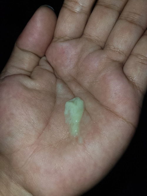 I'm a 2nd mom, 37 weeks and 2 days pregnant ask ko po sana pagihi ko nagsabay yan paglabas ng ihi ko